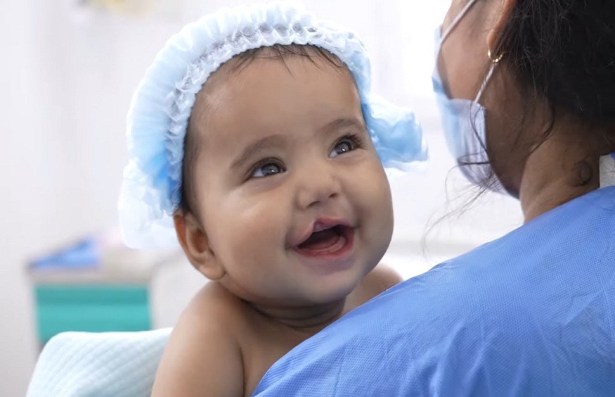 Transforming Cleft Lip Treatment Outcomes