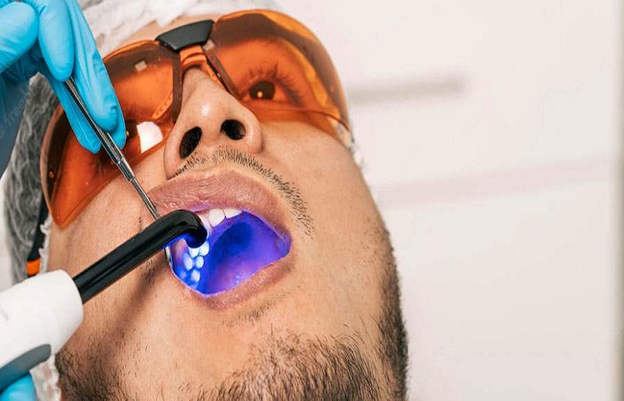 Laser Dentistry